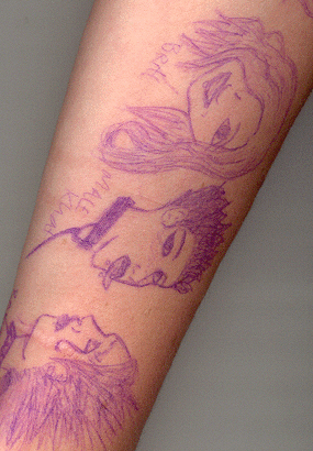 My Arm