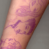 My Arm